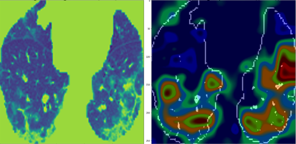 Telerradiologia data base inteligencia artificial coronavirus